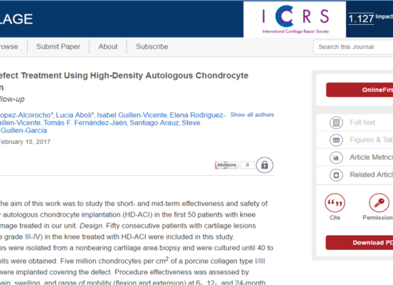 Cartilage Defect Treatment Using High-Density Autologous Chondrocyte Implantation: Two-Year Follow-up