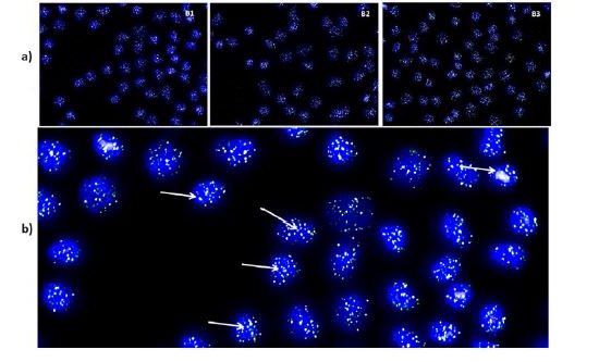 https://pubmed.ncbi.nlm.nih.gov/29322876/